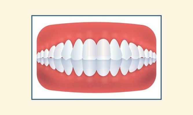 Overbite Human Teeth Icon On Yellow Background.