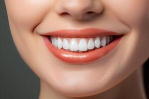 amplio sonrisa de el mujer con genial sano blanco dientes. generativo ai foto
