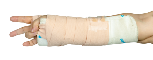 Hand making physical therapy to broken wrist from accident isolated png