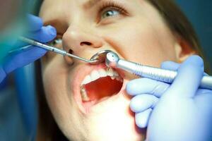 Woman getting a dental treatment photo