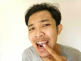 asiático hombre señalando su roto diente foto