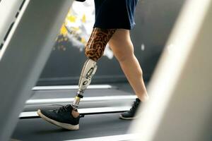 Legs of a young woman with prosthetic leg running and walking on a treadmill at gym photo