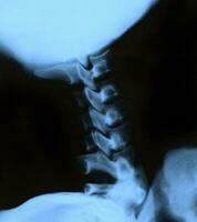 x-ray of the neck photo