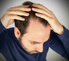 Man controls hair loss photo
