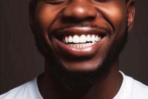 africano sonrisa. blanco dientes de un negro hombre en de cerca. generativo ai foto