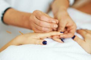 A acupuncture needle therapy in the studio photo