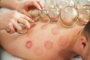 A picture of a man having cupping therapy photo