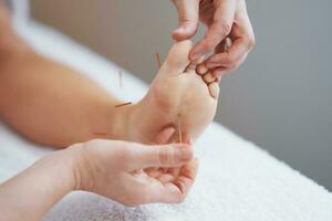 A acupuncture needle therapy in the studio photo