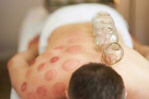 A picture of a man having cupping therapy photo