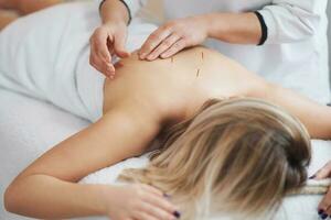 A acupuncture needle therapy in the studio photo