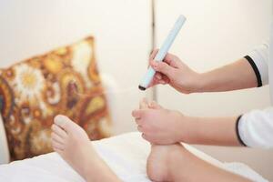 Picture of moxibustion therapy on woman body photo