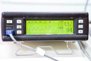 Measuring Oxygen blood saturation device and Pulse Oximeter display for patient in a hospital. Pulse Oximeter display is device used to monitor the symptoms of patients with oxygen deficit problems. photo