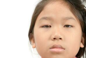 Close up of asian little girl one eye infection isolated photo