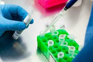 Closeup of a scientist extracting DNA using the spin column-based nucleic acid purification technique. Spin column-based nucleic acid purification technique. Diagnosis of human papillomavirus virus. photo