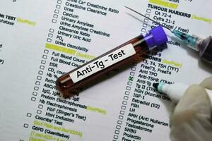 Anti-Tg - Test with blood sample. Top view isolated on office desk. Healthcare Medical concept photo