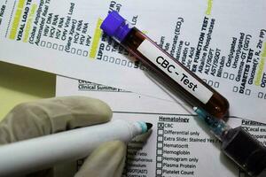 cbc - prueba con sangre muestra. parte superior ver aislado en oficina escritorio. cuidado de la salud médico concepto foto