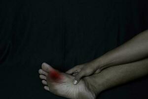 Asian Man Holding his foot. He feels pain from corn on his foot sole with black background. Medical or healthcare concept photo