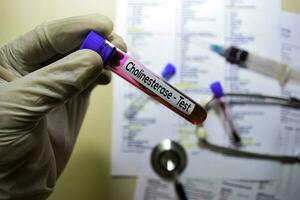 Cholinesterase - Test with blood sample. Top view isolated on office desk. Healthcare Medical concept photo