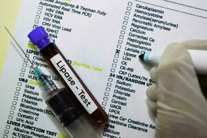 Lipase - Test with blood sample. Top view isolated on office desk. Healthcare Medical concept photo