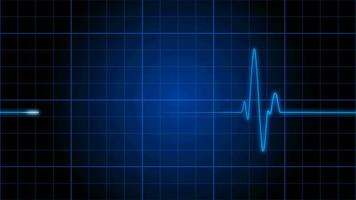 An electrocardiogram heart monitor pulses on a blue grid - Loop video