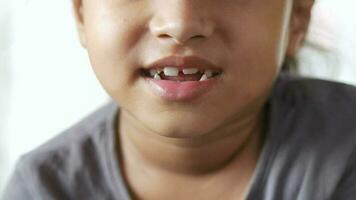 enfant fille souriant avec des dents déformées video