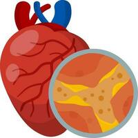 colesterol en vena y arterias corazón y Organo enfermedad. bloqueo y obstrucción de canal. magnificado ver debajo microscopio. salud problema. plano médico educación vector