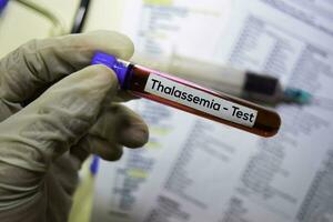 Thalassemia - Test with blood sample. Top view isolated on office desk. Healthcare Medical concept photo