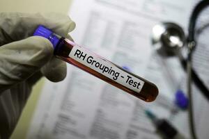 RH Grouping - Test with blood sample. Top view isolated on office desk. Healthcare Medical concept photo