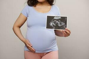 recortado ver embarazada mujer acariciando su barriga, demostración a cámara el recién nacido bebé ultrasonido escanear terminado blanco fondo foto