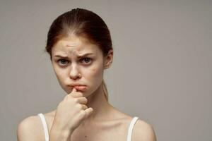 pretty woman in a white t-shirt pimples on the face close-up photo