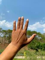 Man's hands are darkened from working outdoors without protection from the daytime sun.Skin exposed to sunlight on a regular basis can cause melanoma. photo