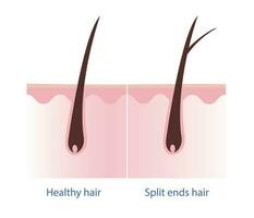 Healthy hair and split ends hair with scalp layer vector on white background. Hair care concept illustration.