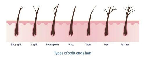 Types of split ends hair, baby split, y split, incomplete, knot, taper, tree, feather with scalp layer vector on white background. Hair care concept illustration.