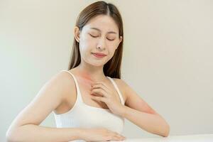 Dermatology, asian young woman, girl allergy, allergic reaction from atopic, insect bites on her body, hand in scratching itchy, itch red spot or rash of skin. Healthcare, treatment of beauty. photo