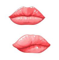 Edema or angioedema, medical swelling of lips vector