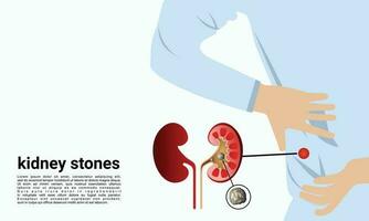 Human Kidney Stones, Kidney Inside, Kidney System, Bean shape, Vector illustration.