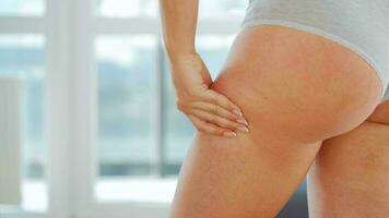 donna compressione il pelle di il natiche e gambe controllo per cellulite e eccesso sottocutaneo Grasso video