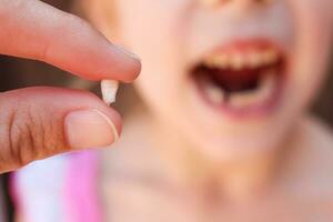 At 6 years old child has lost baby tooth. photo