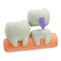 Dental Crown 3D Illustration png
