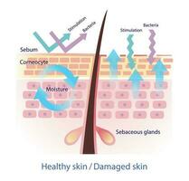 comparación de sano y dañado piel barrera vector en blanco antecedentes. el sano sebo barrera proteger piel desde estímulo y bacterias cuando sebo disminuido, dirigir a más agua dejando piel.