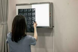 Physician and radiologist analyze medical images, including MRI film, to identify patient condition in order to develop treatment plans and future medical procedures, refer patients to specialists. photo