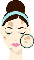 Flat Style Smart Girl With Melasma On Face Icon. vector