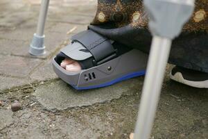 mujeres pies rotos con una bota de plástico gris tobillera protección contra lesiones bota foto