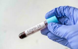 sonda de prueba de coronavirus foto