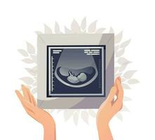 Ultrasonography picture, ultrasound scan of fetus in woman hands. Positive pregnancy test. Fetus silhouette in mother womb. Pregnancy symbol. Diagnostic sonography concept. Vector illustration.