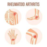 reumatoide artritis iconos rodilla articulación, hombro articulación, muñeca articulación, pie articulación. tipos de artritis. médico concepto. vector