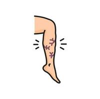 Varicose vein, venous edema on leg line icon vector