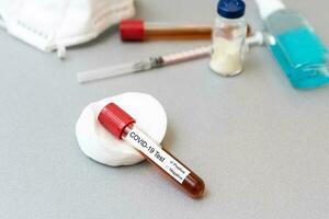 test tubes with vaccines on the table photo