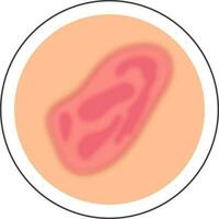 Pink And Peach Bruise Skin Disease Circle Icon In Flat Style. vector