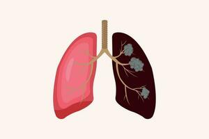 lung cancer and normal lung illustration comparation. eps 10. icon set vector